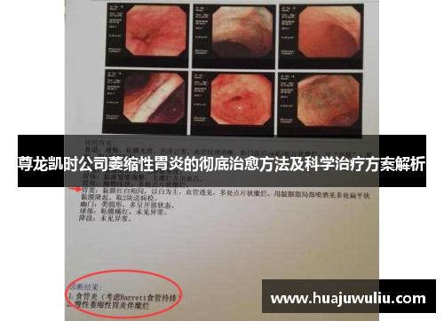 尊龙凯时公司萎缩性胃炎的彻底治愈方法及科学治疗方案解析